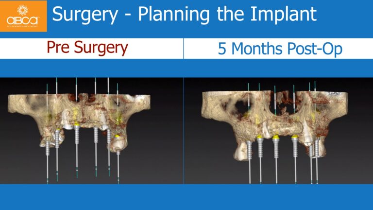 Clinical Case