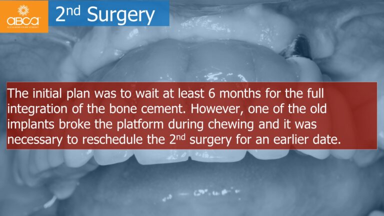 Clinical Case