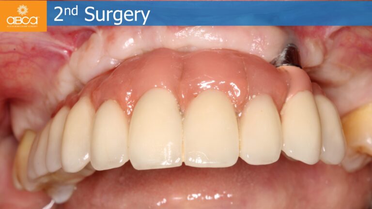 Clinical Case