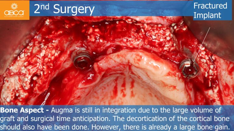 Clinical Case