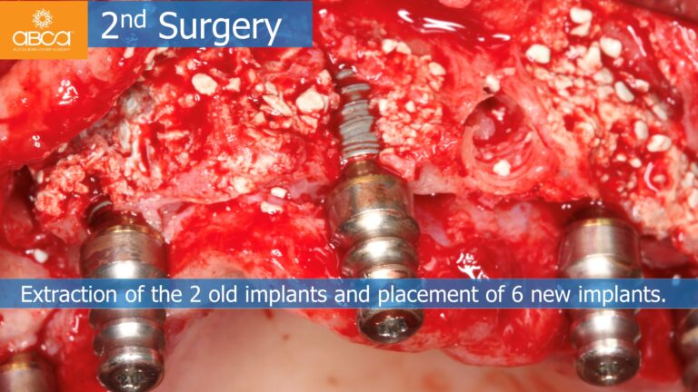 Clinical Case