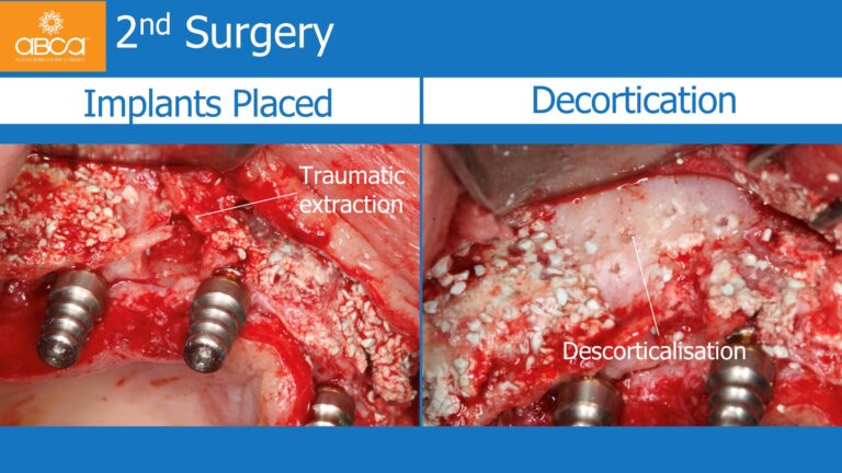 Clinical Case