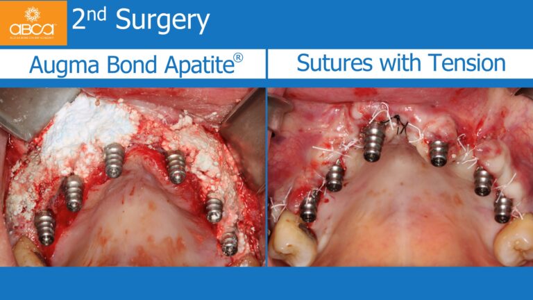 Clinical Case