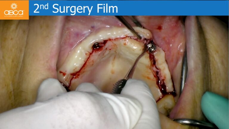 Clinical Case