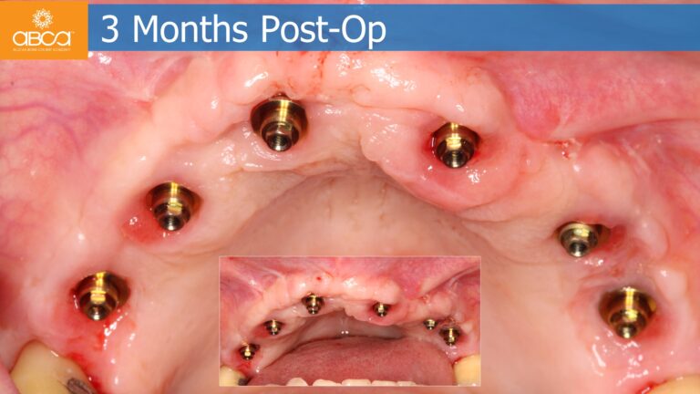 Clinical Case