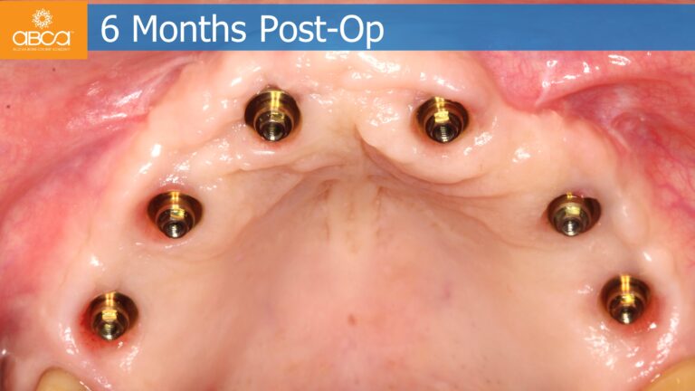 Clinical Case