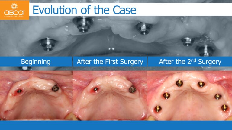 Clinical Case
