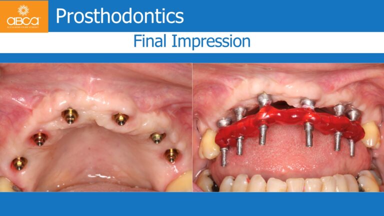 Clinical Case