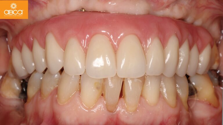 Clinical Case