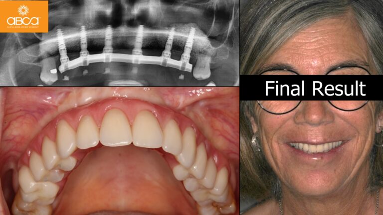 Clinical Case