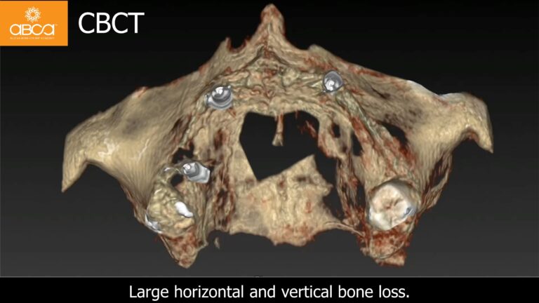 Clinical Case