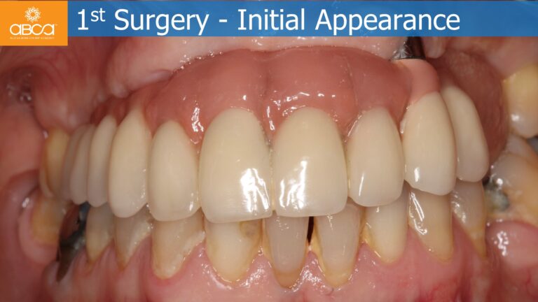 Clinical Case