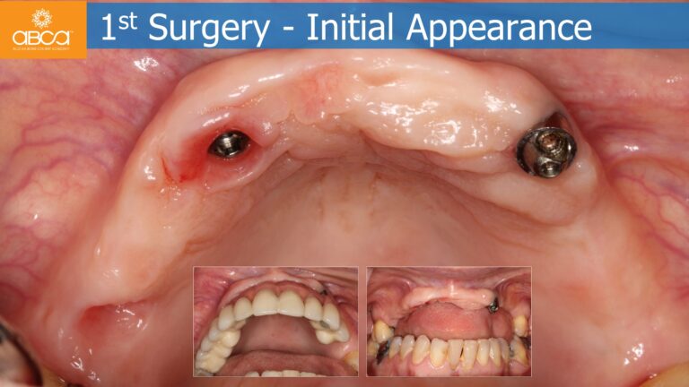Clinical Case