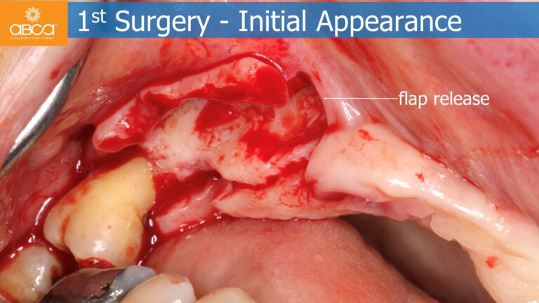 Clinical Case