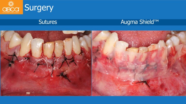 Clinical Case