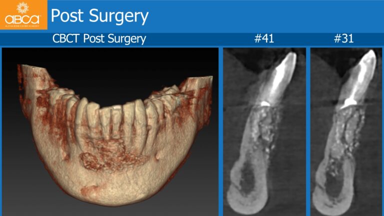 Clinical Case