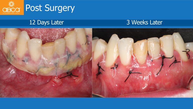 Clinical Case