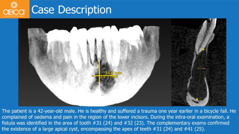 Clinical Case