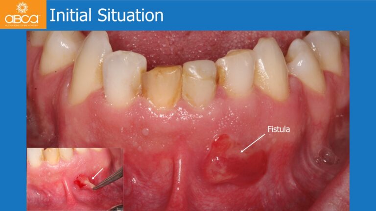 Clinical Case