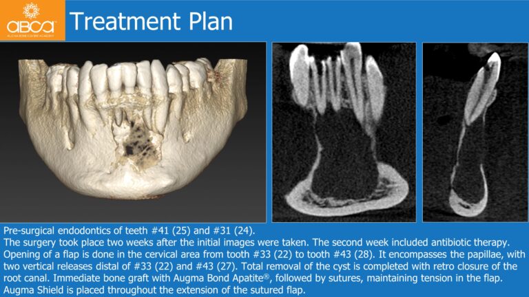 Clinical Case