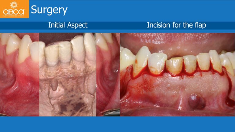 Clinical Case