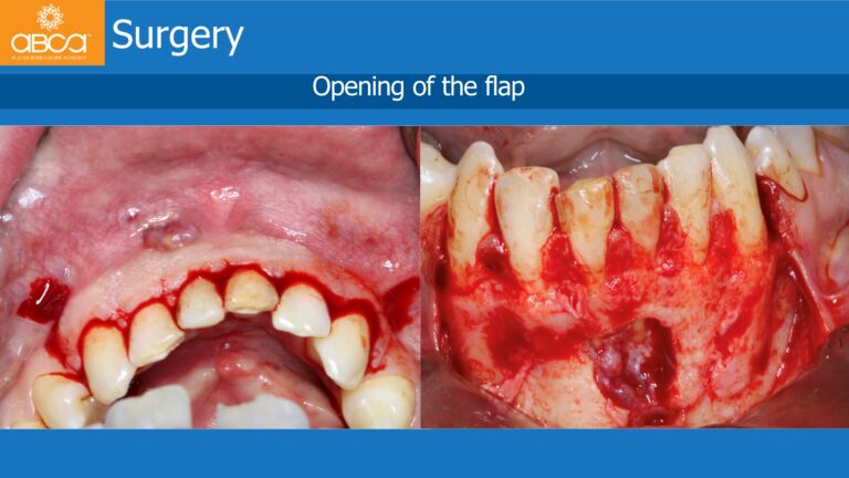 Clinical Case