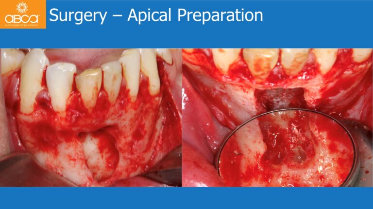 Clinical Case