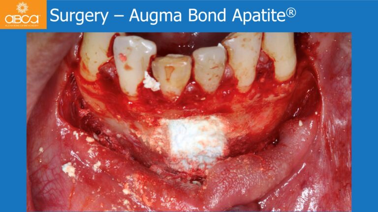 Clinical Case