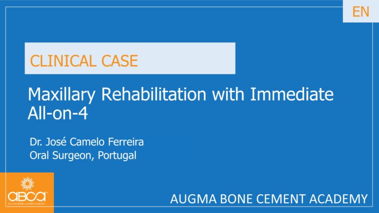 Maxillary Rehabilitation with Immediate All-on-4