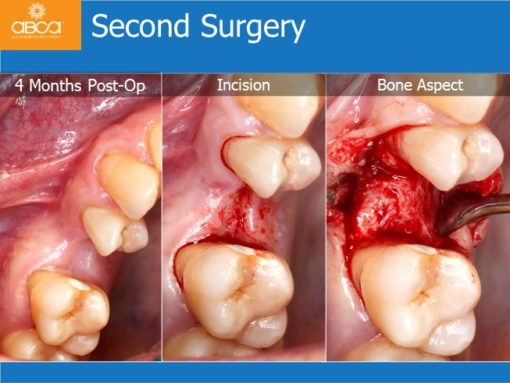 Clinical Case