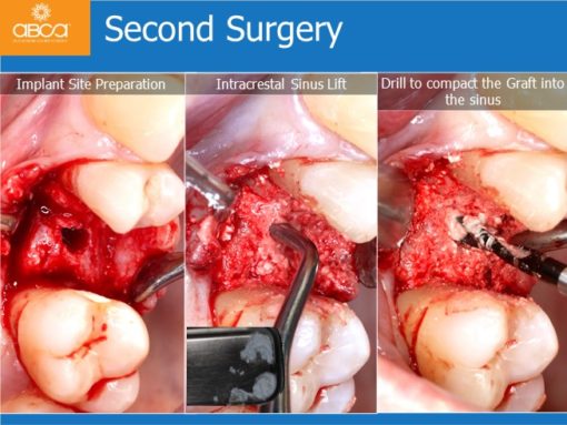 Clinical Case