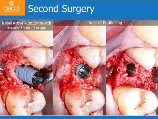 Clinical Case