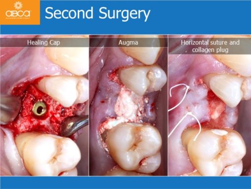 Clinical Case