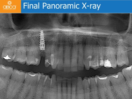 Clinical Case