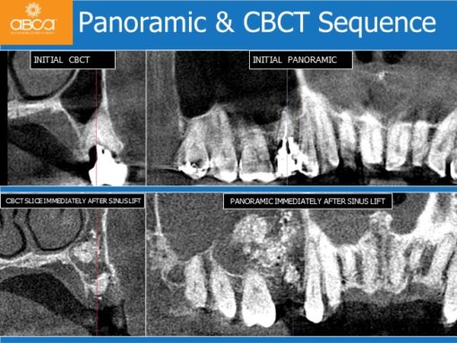 Clinical Case