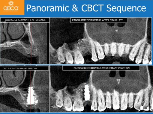 Clinical Case