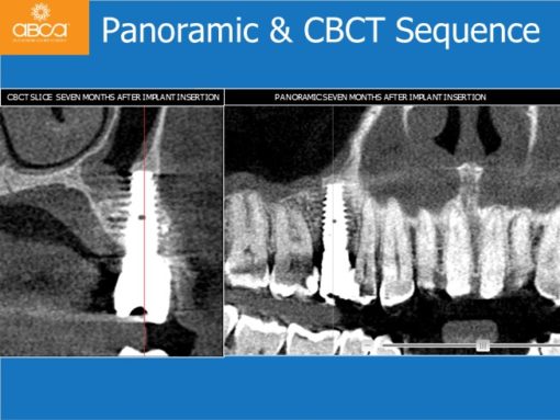 Clinical Case