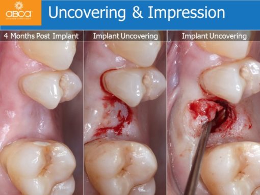 Clinical Case