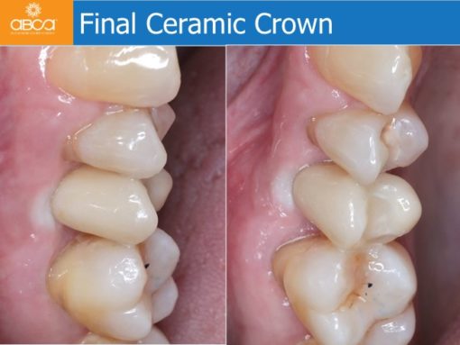 Clinical Case