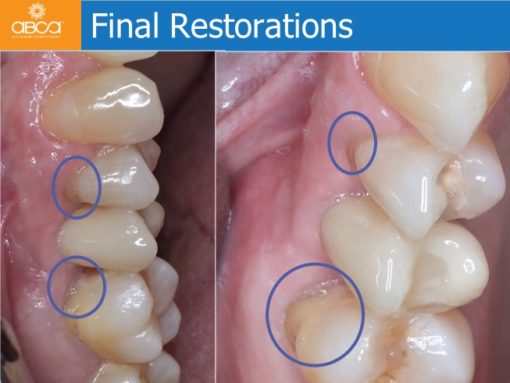 Clinical Case