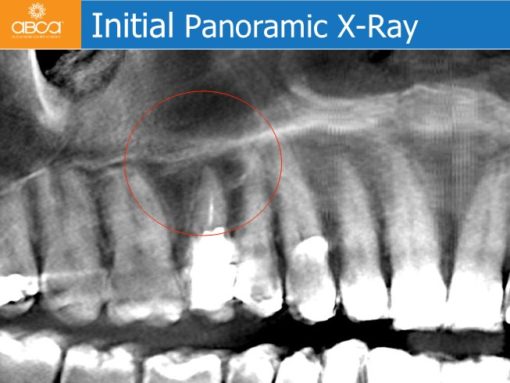 Clinical Case