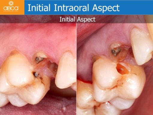 Clinical Case