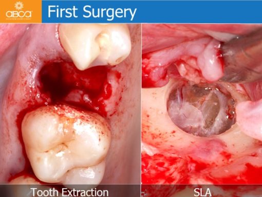 Clinical Case