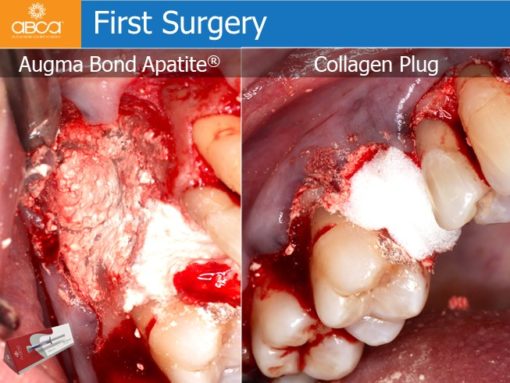 Clinical Case