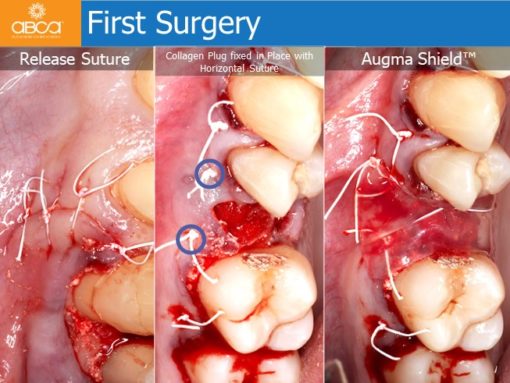 Clinical Case