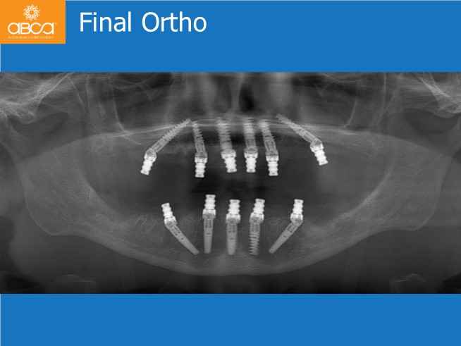 Clinical Case