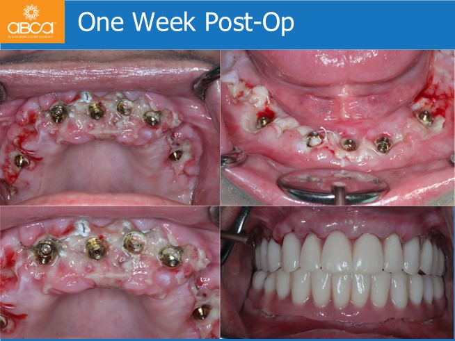 Clinical Case
