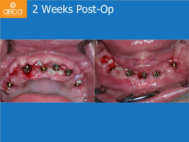 Clinical Case