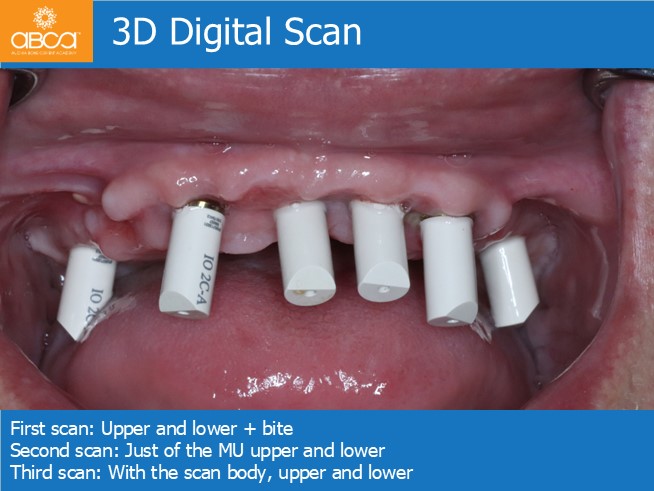 Clinical Case