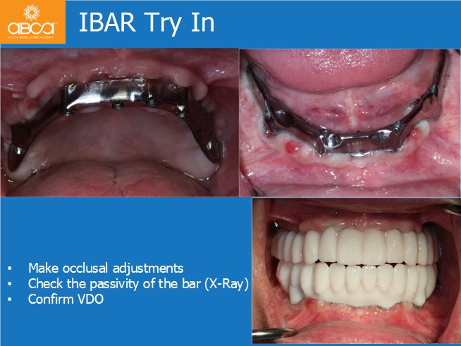 Clinical Case
